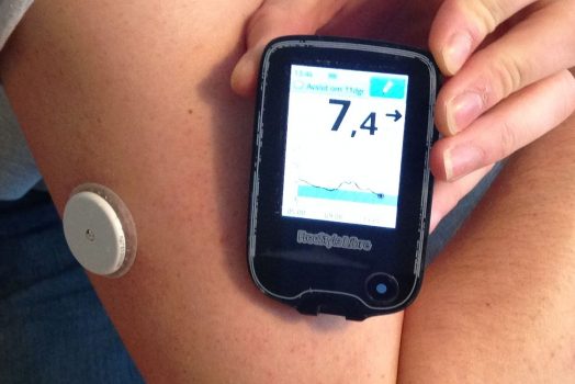 The Blood Glucose Sensor That People Should Be Using