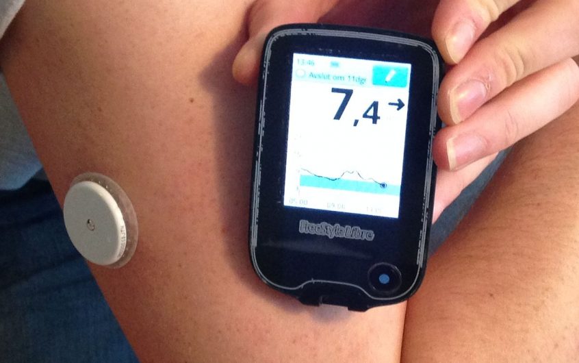 The Blood Glucose Sensor That People Should Be Using